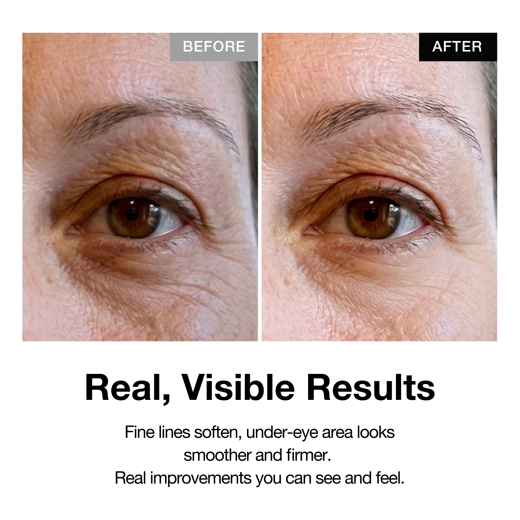 Smooth Retinol Cream | 0.1% Retinol + 0.5% Bakuchiol for Face, Neck & Eyes